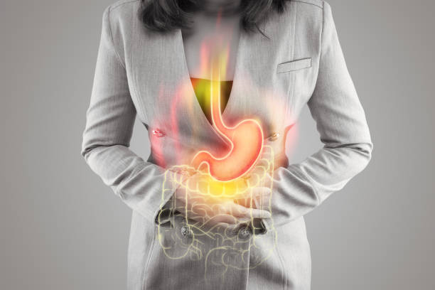 رفلاکس یا برگشت اسید معده از به مری چه تاثیری روی موی بد دهان دارد؟