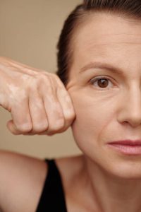 لیفت صورت چیست؟ انواع، روش‌ها، برندها و ماندگاری (توصیه‌های دکتر امین صدرایی)