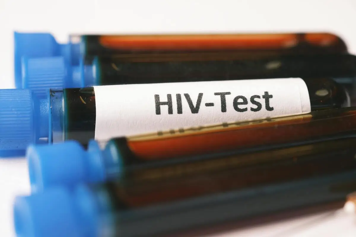 زگیل تناسلی در مردان بررسی کامل علائم، علل، تشخیص و درمان HPV