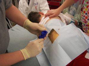 آزمایش مغزاستخوان چیست؟ راهنمای کامل تشخیص بیماری‌های خونی و سرطان‌ها