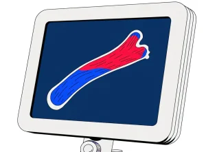 داپلر جنینی (Fetal / Obstetric Doppler)