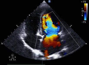 سونوگرافی داپلر: راهنمای کامل تشخیص جریان خون و سلامت جنین + مزایا، انواع و تفسیر نتایج