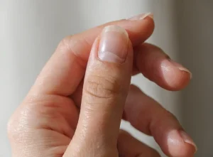عوارض کاشت ناخن؛ از حساسیت پوستی تا عفونت و آسیب ناخن طبیعی