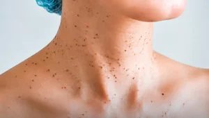 خال قرمز روی بدن نشانه چیست؟ علت زیاد شدن، انواع و زمان مراجعه به پزشک