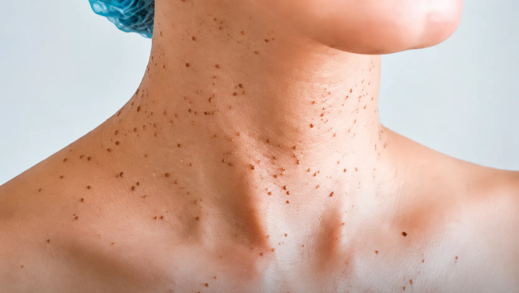 خال قرمز روی بدن نشانه چیست؟ بررسی دلایل، خطرات و زمان مراجعه به پزشک