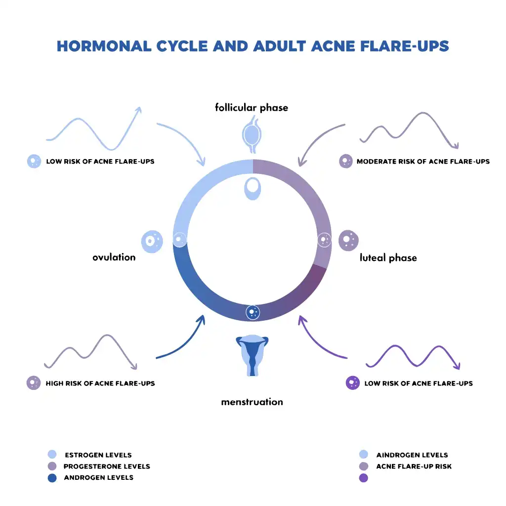 A clean comparison diagram showing common acne types (comedones, papules, nodules) as simplified cross-sectional skin illustrations. Educational, labeled, no graphic imagery, soft professional colors, medical textbook style.