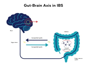 سندرم روده تحریک‌پذیر (IBS)؛ علائم، انواع و مدیریت
