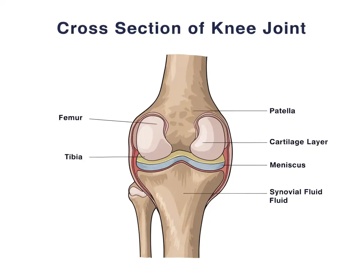 ساییدگی زانو (Knee Osteoarthritis)؛ درجه‌بندی، علائم و رویکردهای مدیریت