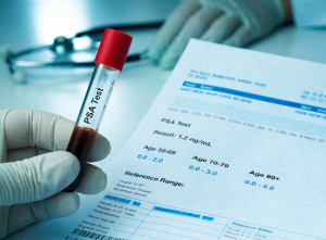 آزمایش PSA چیست؟ غربالگری سلامت پروستات در مردان