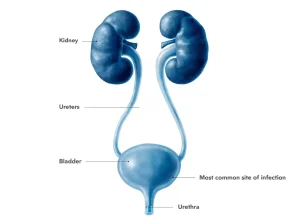 عفونت ادراری (UTI)؛ علائم، علل و درمان در زنان و مردان