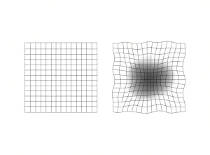 تست شبکهٔ آمسلر (Amsler Grid)