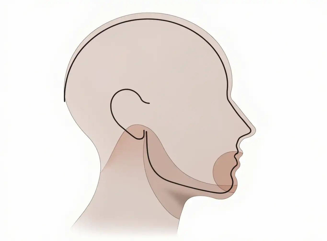 پروتز چانه و ژنیوپلاستی (Chin Augmentation / Genioplasty)