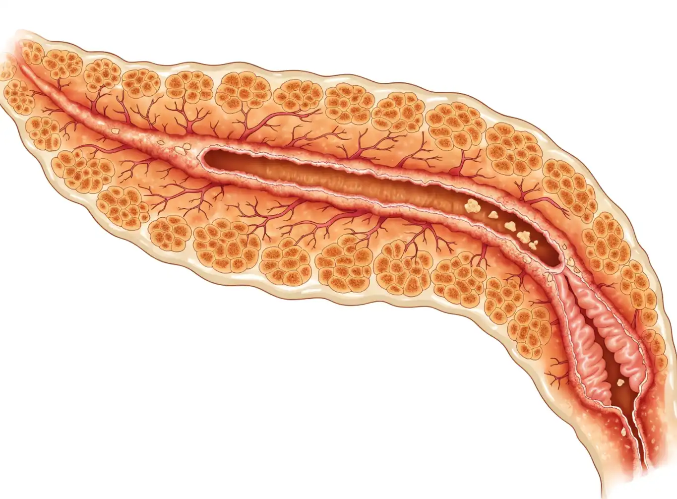 پانکراتیت (Pancreatitis) چیست؟