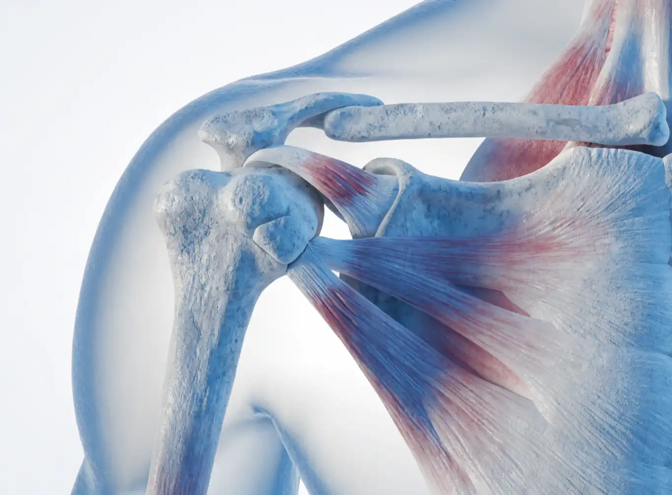 پارگی تاندون روتاتور کاف شانه (Rotator Cuff Tear)
