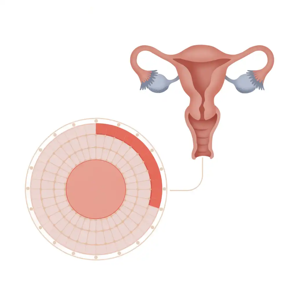خونریزی شدید قاعدگی (Heavy Menstrual Bleeding / Menorrhagia) چیست؟