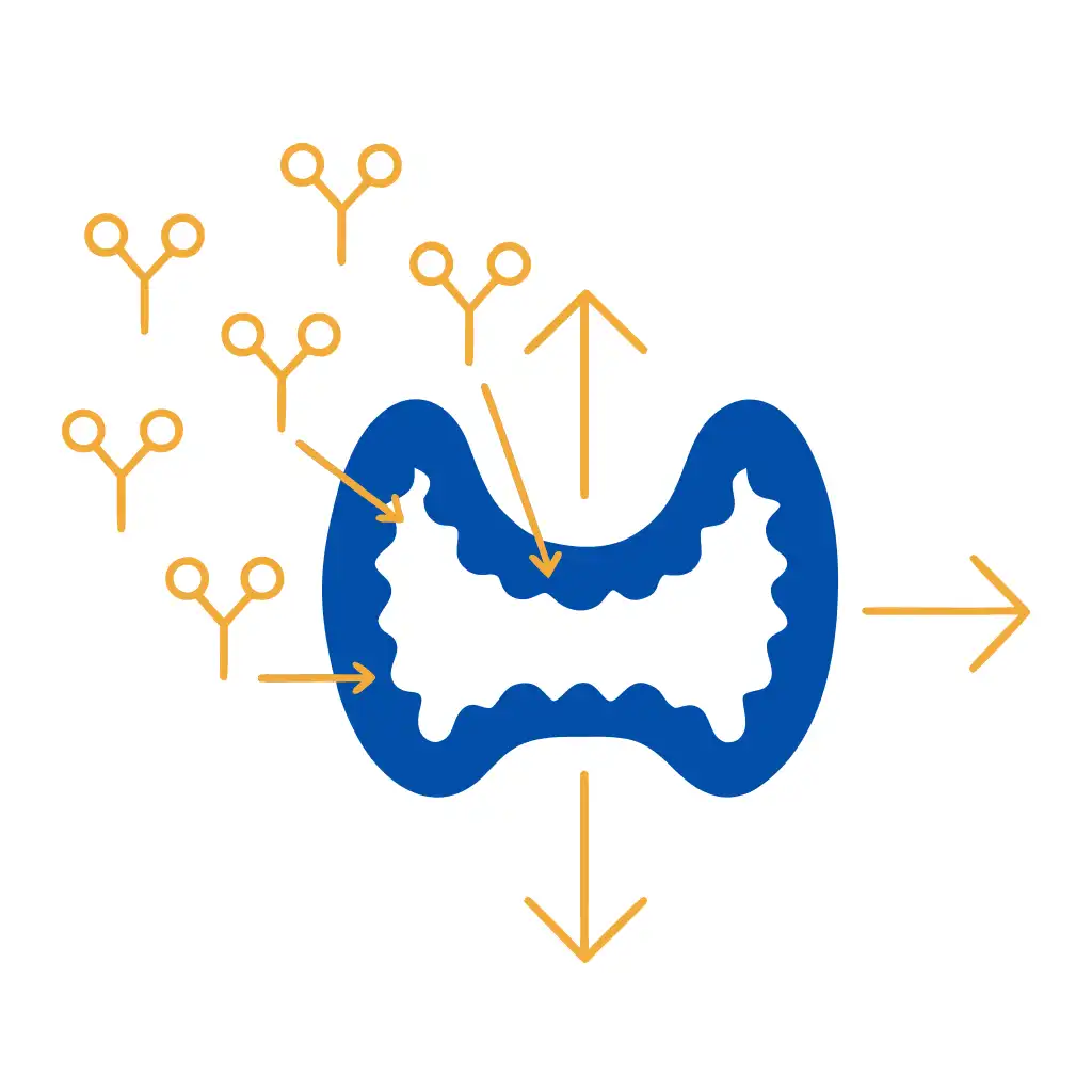 اصول کلی درمان بیماری گریوز