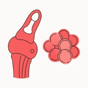 آرتریت پسوریاتیک (Psoriatic Arthritis)